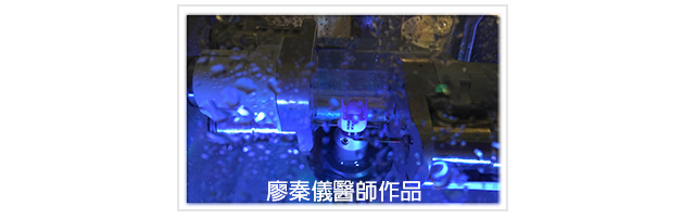 3D齒雕,竹北3D齒雕,美容牙科,前牙斷裂修復