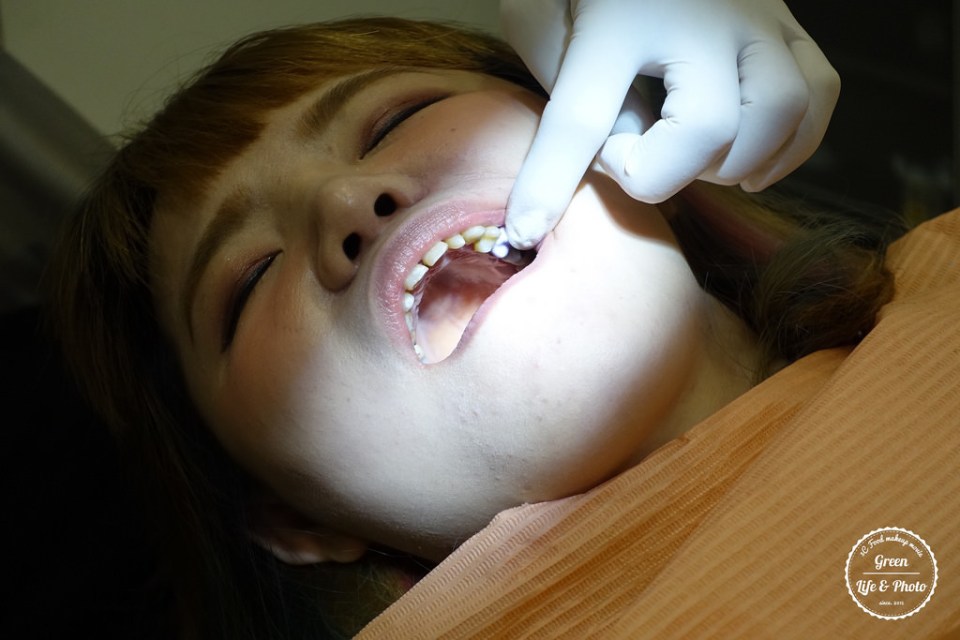 植牙專科,3D齒雕,美容牙科,晶鑽全瓷