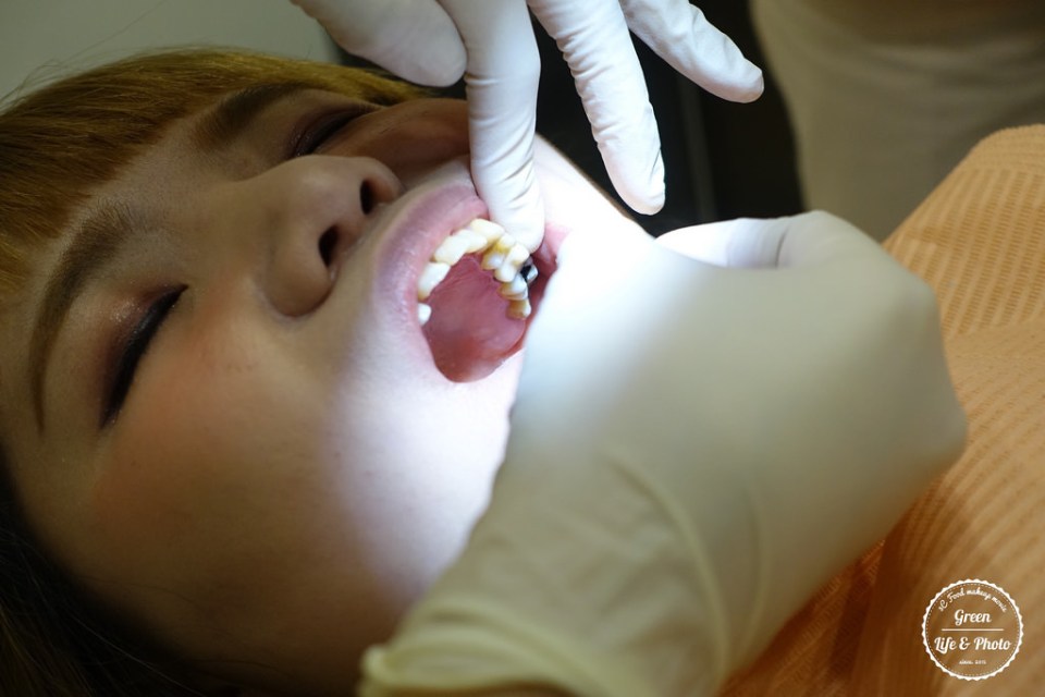 植牙專科,3D齒雕,美容牙科,晶鑽全瓷