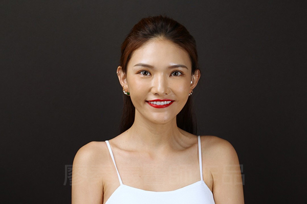上顎牙齦美容,晶鑽全瓷冠,全瓷貼片