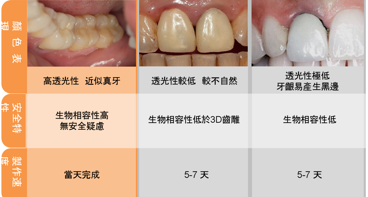 3d齒雕缺點，3d齒雕壽命，牙醫師填補缺損數位瓷塊形狀高度密合