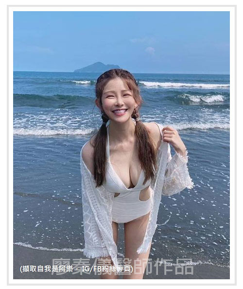 3D齒雕,3d齒雕缺點,美容牙科,竹北牙齒美白