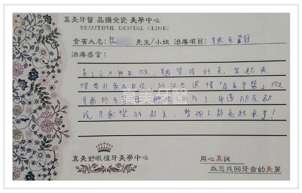 3D齒雕,3d齒雕缺點,美容牙科,竹北牙齒美白