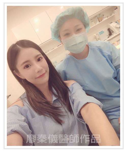 3D齒雕,3D齒雕CEREC,3d齒雕缺點,一日美齒CEREC,美容牙科,竹北牙齒美白