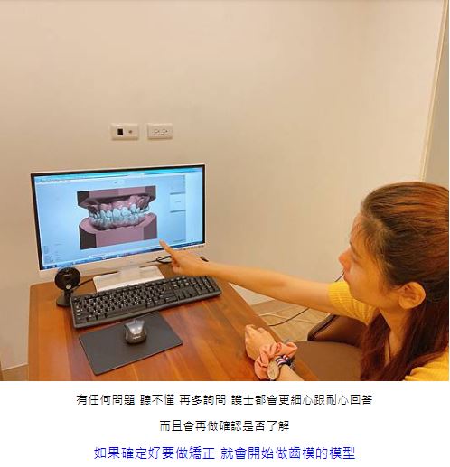 數位3D隱形矯正,竹北數位3D隱形矯正,快速矯正,竹北快速矯正,3D齒雕,美容牙科,舒眠植牙,植牙專科,一日植牙,新竹縣市牙醫診所