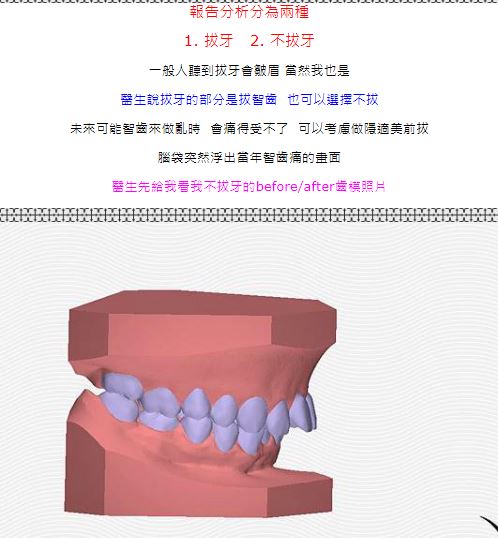 數位3D隱形矯正,竹北數位3D隱形矯正,快速矯正,竹北快速矯正,3D齒雕,美容牙科,舒眠植牙,植牙專科,一日植牙,新竹縣市牙醫診所