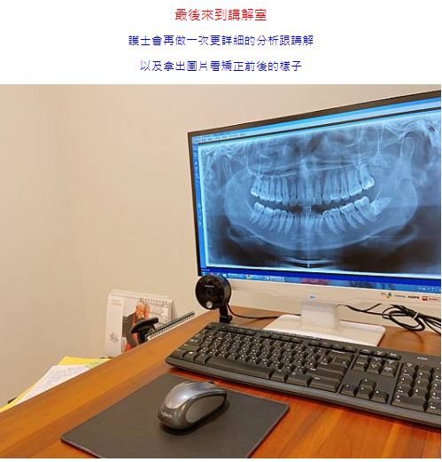 數位3D隱形矯正,竹北數位3D隱形矯正,快速矯正,竹北快速矯正,3D齒雕,美容牙科,舒眠植牙,植牙專科,一日植牙,新竹縣市牙醫診所