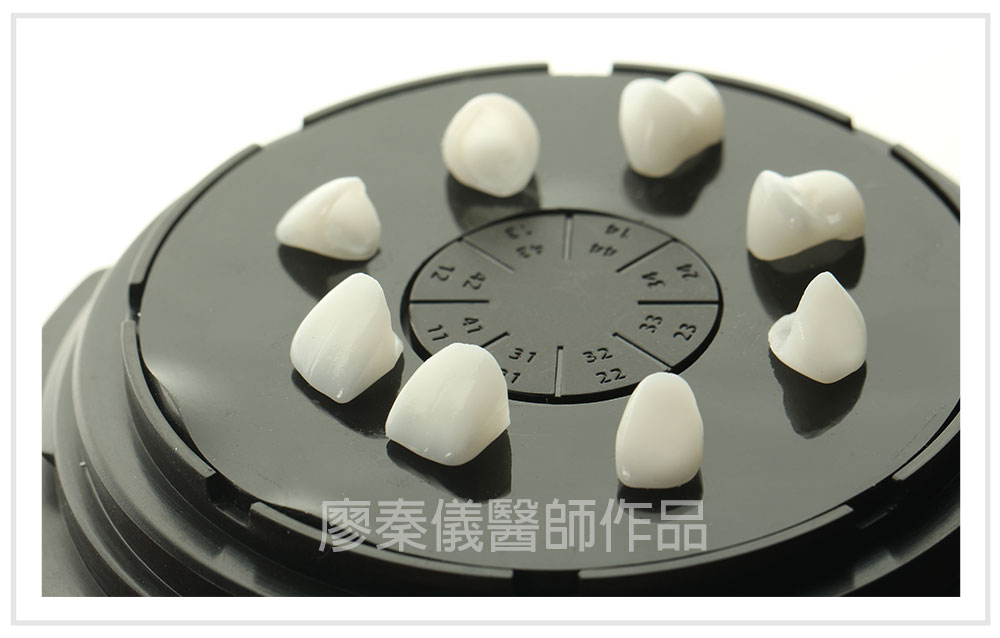 3D齒雕,竹北3D齒雕,美容牙科,3D齒雕門牙