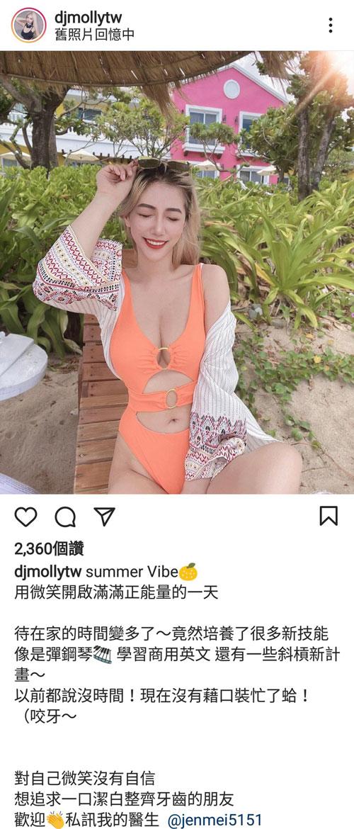3D齒雕,3d齒雕缺點,美容牙科,竹北牙齒美白