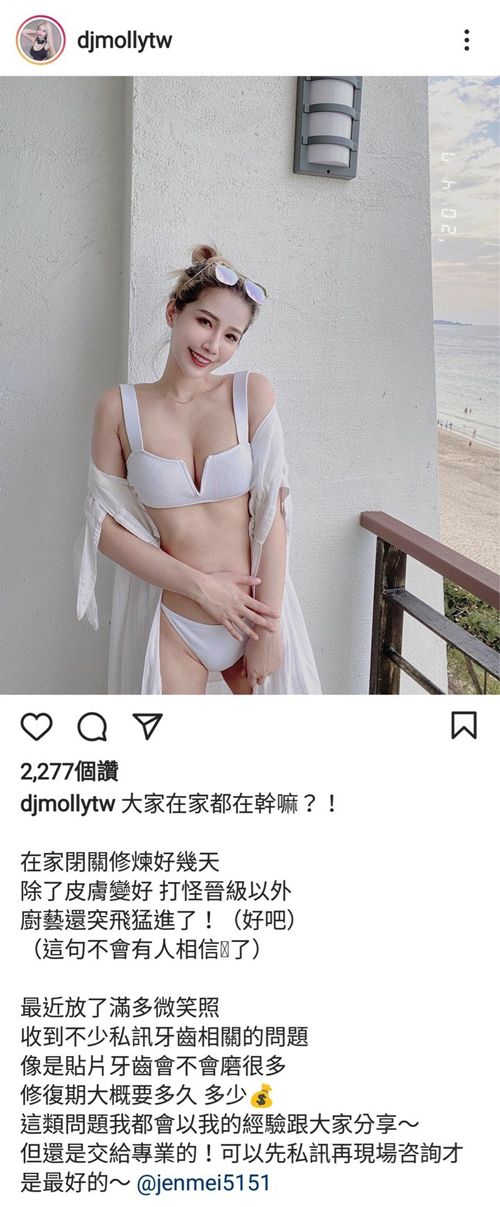 3D齒雕,3d齒雕缺點,美容牙科,竹北牙齒美白