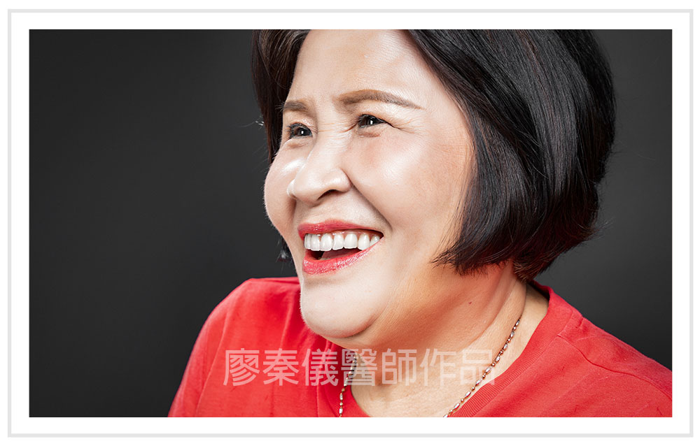all on 4全口重建費用ptt,費用可以分期嗎