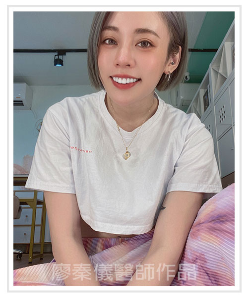 3D齒雕,牙齦對稱手術,美容牙科,3D齒雕門牙,晶鑽全瓷冠,竹北3D齒雕,竹北牙齦對稱手術,牙齦美容,一日美齒cerec,CEREC 3D齒雕