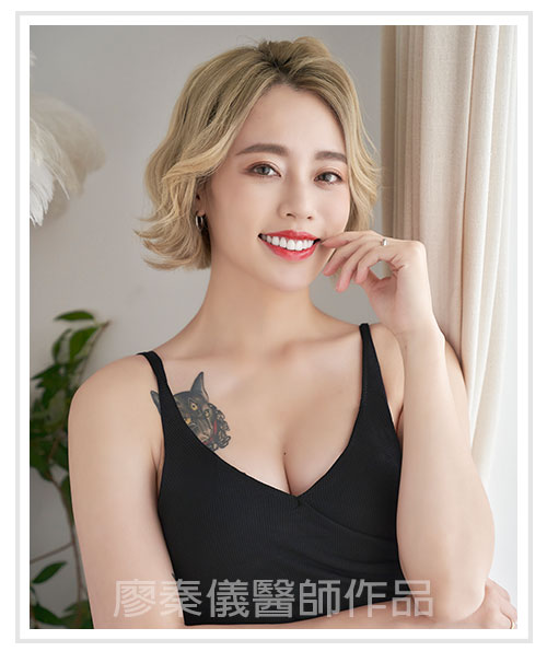 3D齒雕,牙齦對稱手術,美容牙科,3D齒雕門牙,晶鑽全瓷冠,竹北3D齒雕,竹北牙齦對稱手術,牙齦美容,一日美齒cerec,CEREC 3D齒雕