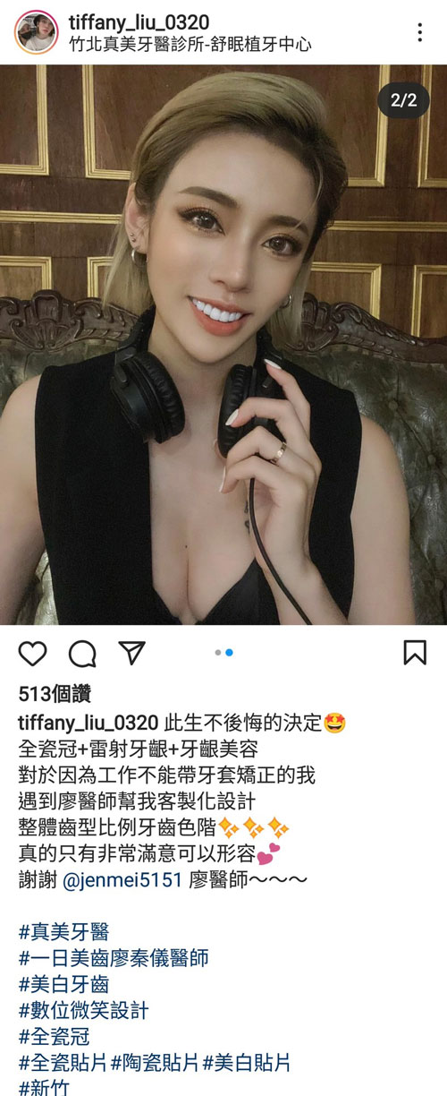 3D齒雕,牙齦對稱手術,美容牙科,3D齒雕門牙,晶鑽全瓷冠,竹北3D齒雕,竹北牙齦對稱手術,牙齦美容,一日美齒cerec,CEREC 3D齒雕