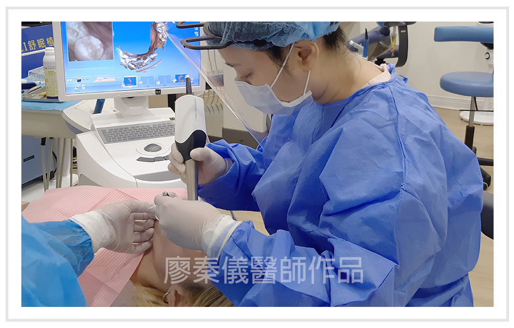 3D齒雕,牙齦對稱手術,美容牙科,3D齒雕門牙,晶鑽全瓷冠,竹北3D齒雕,竹北牙齦對稱手術,牙齦美容,一日美齒cerec,CEREC 3D齒雕