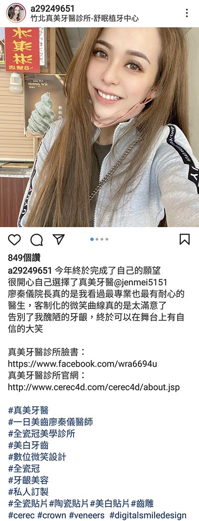 上顎牙齦美容,美容牙科