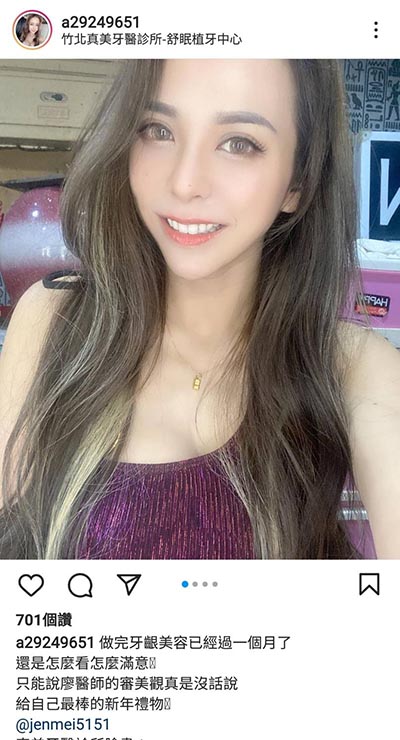 上顎牙齦美容,美容牙科