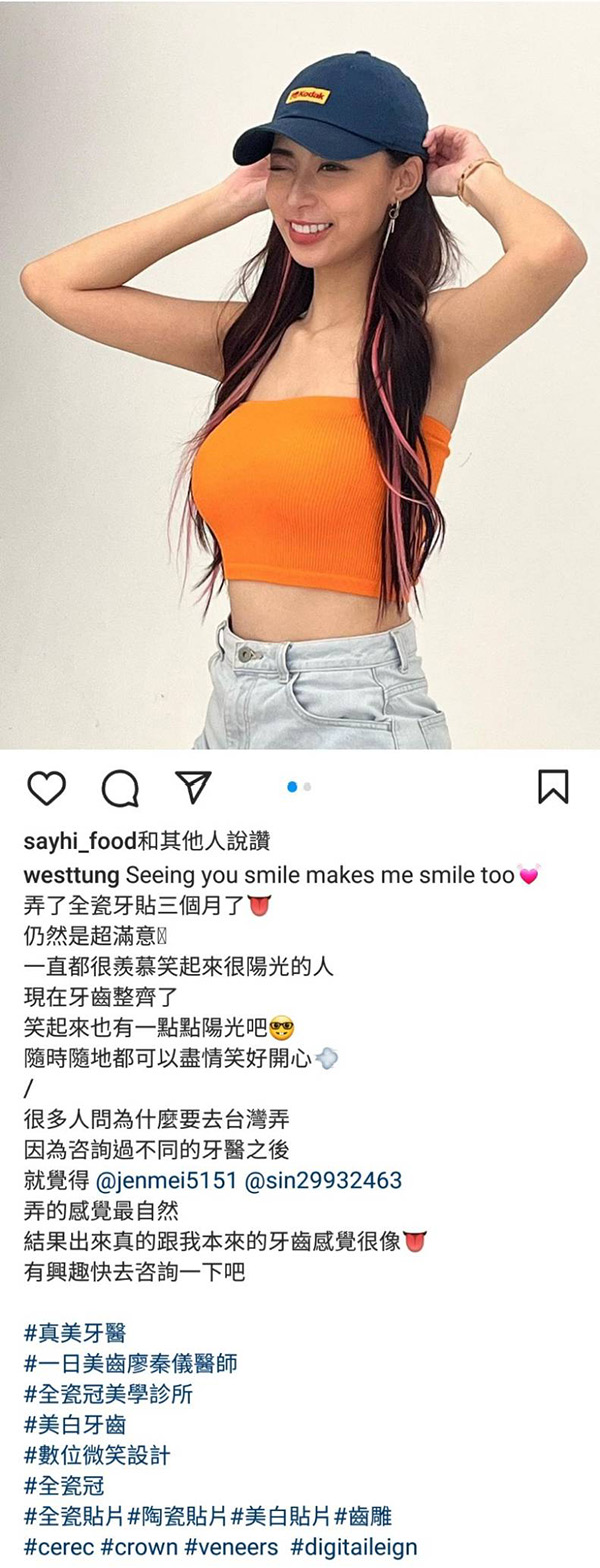 微笑曲線設計,全瓷貼片