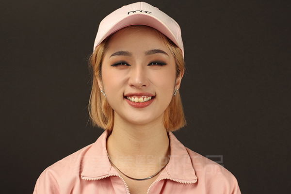 新竹牙齦美容,新竹微笑曲線設計,新竹全瓷齒雕