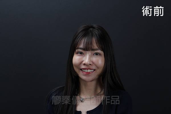 陶瓷貼片