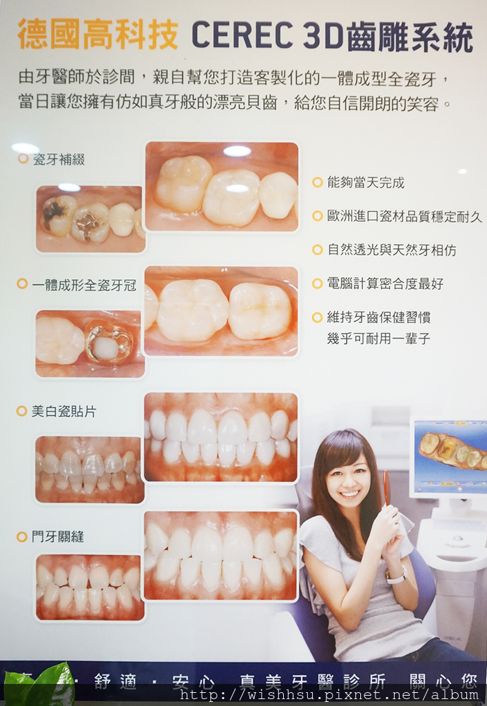 德國高科技CEREC 3D齒雕系統