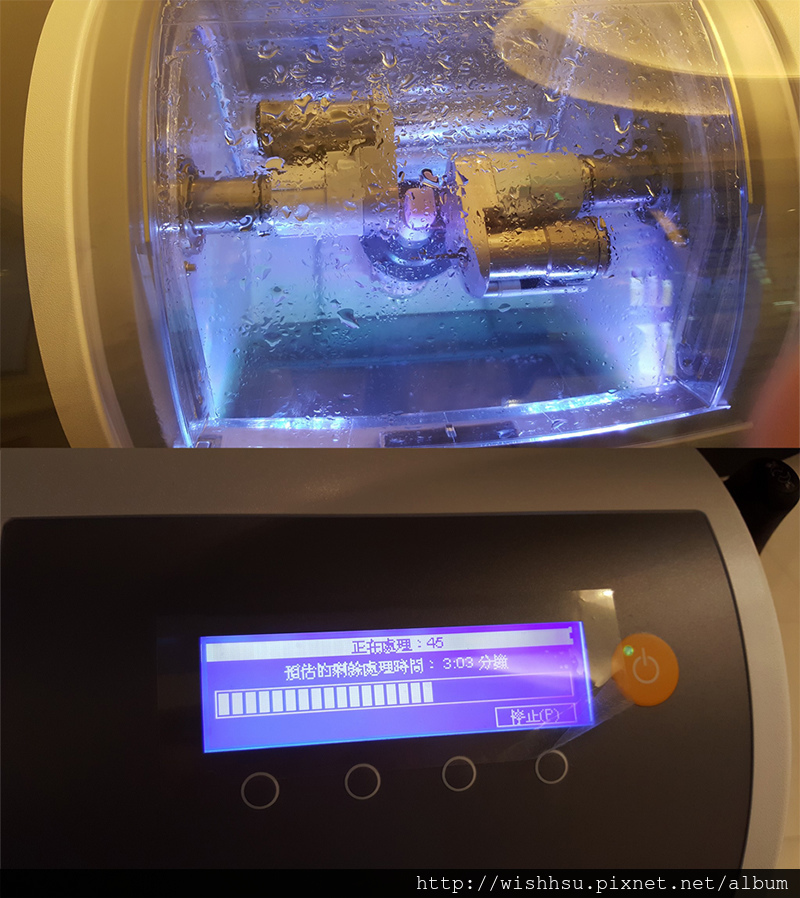 植牙專科,3D齒雕,美容牙科,晶鑽全瓷,即拔即種植牙