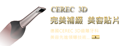 CEREC 3D 完美補綴美容貼片
