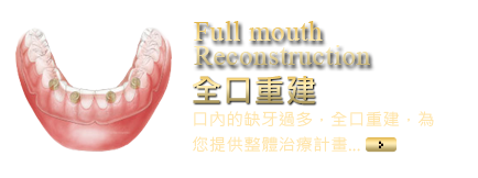 Full mouth Reconstruction 全口重建